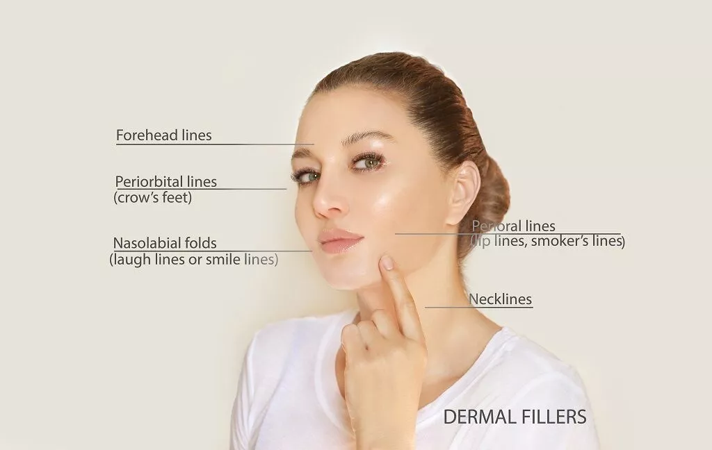 Unveiling the Types of Facial Fillers Metropolitan Skin Clinic
