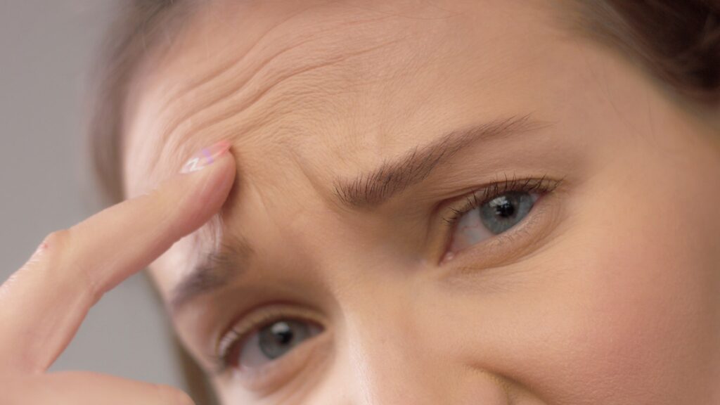 Our Featured Deep Forehead Wrinkles Botox Treatment