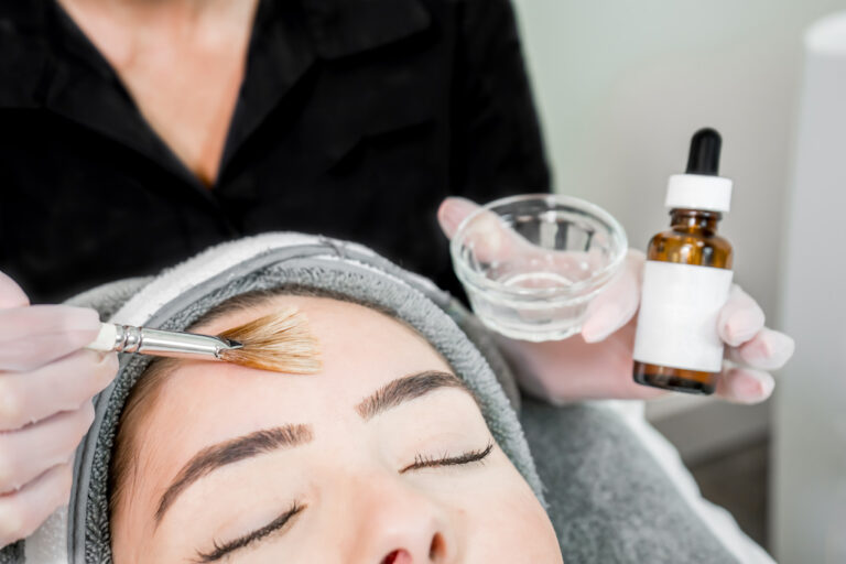 Everything You Need to Know About a Chemical Peel
