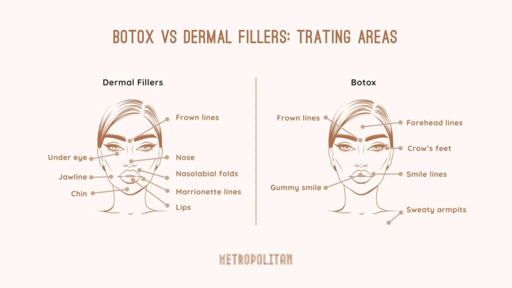 WHAT DOES BOTOX TREAT?