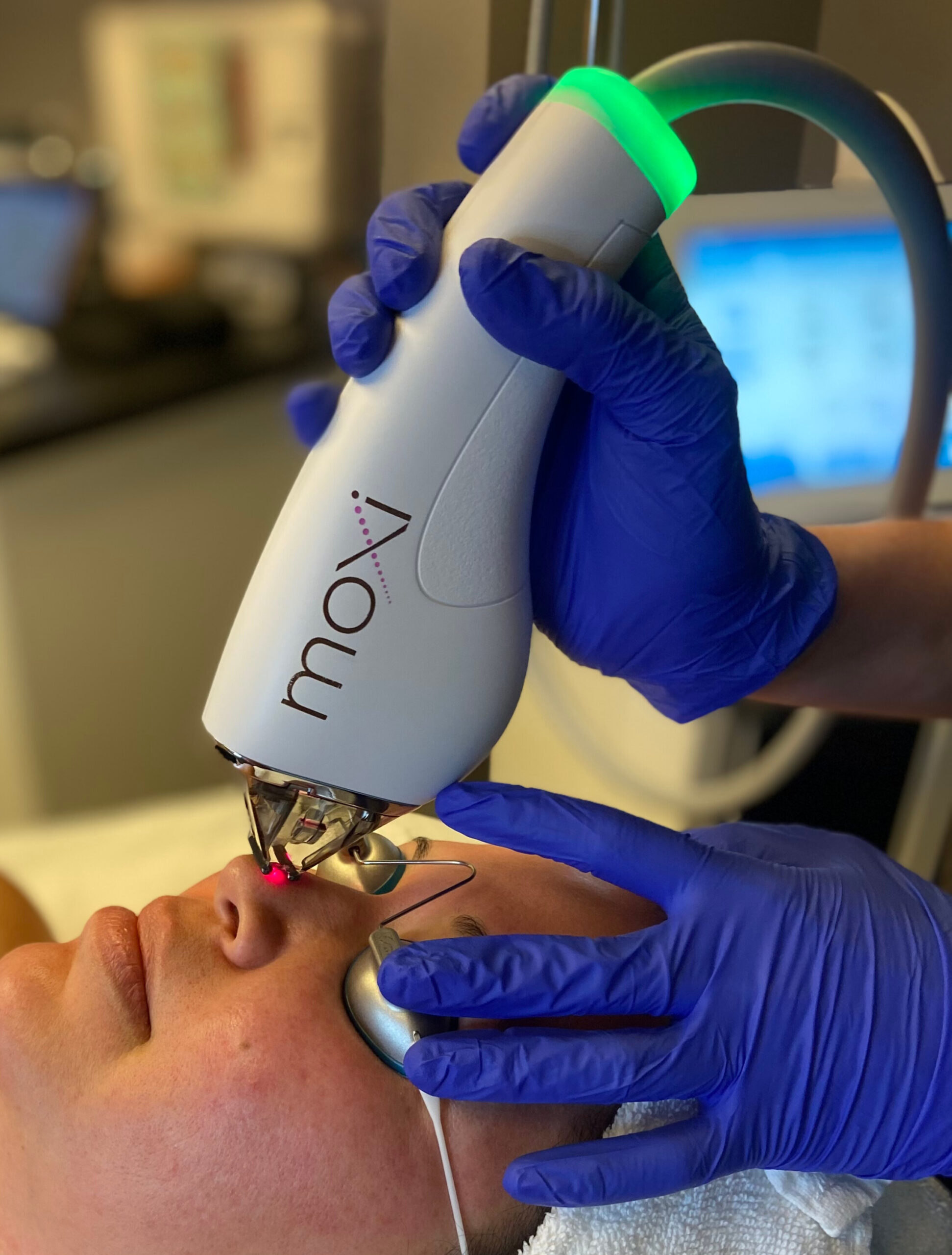 Rejuvenate Your Skin with Moxi Laser Treatment in Edina MN