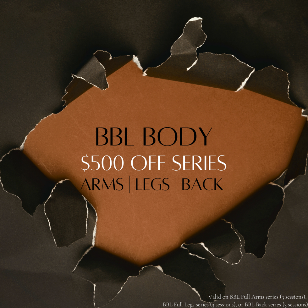 BBL Arms | Legs | Back