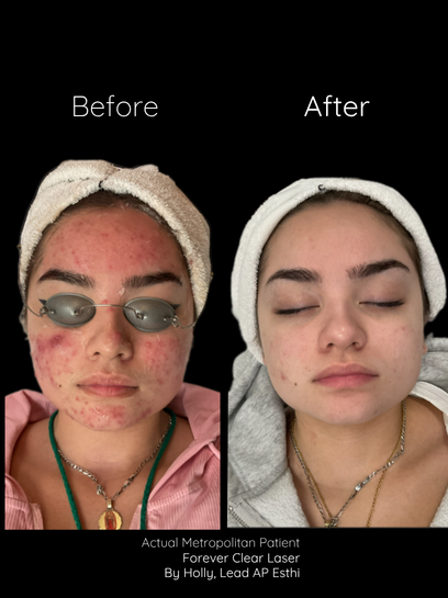 Summer Skin Rejuvenation