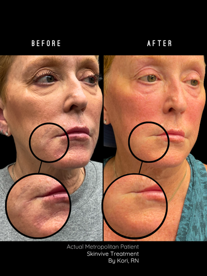 Lip & Hydration Refresh | $1,550 Value