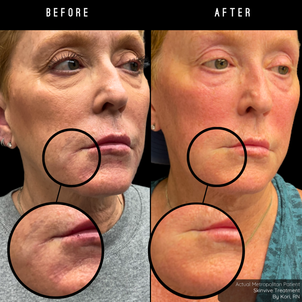 Lip & Hydration Refresh | $1,550 Value