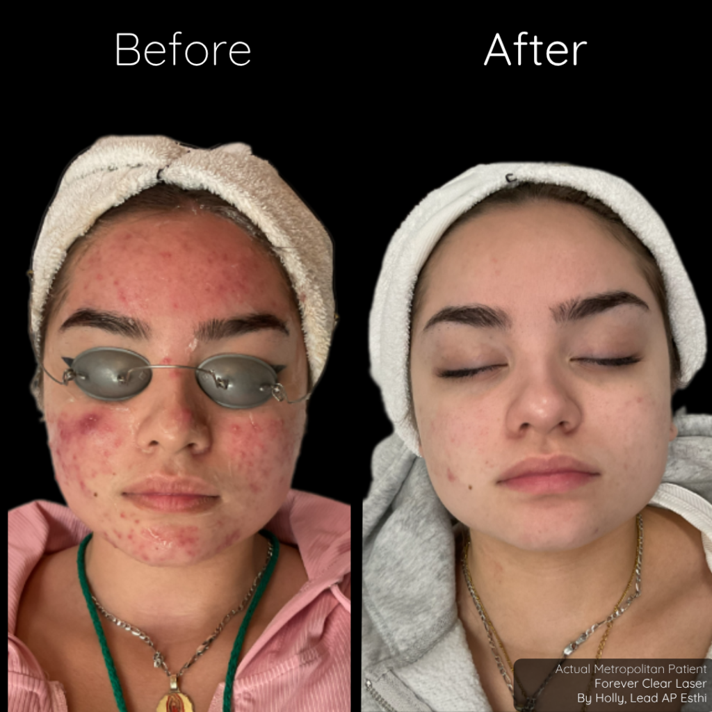 Summer Skin Rejuvenation