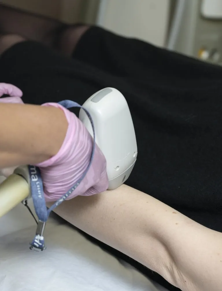 Laser Hair Removal