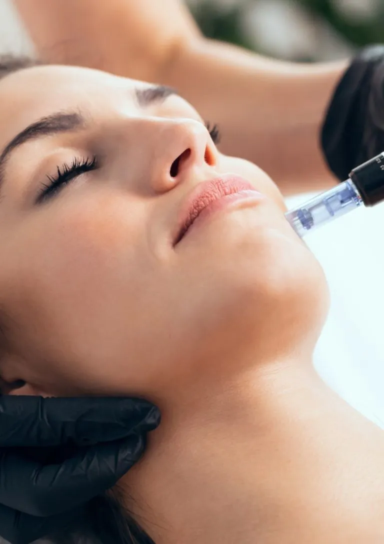 Microneedling Treatment